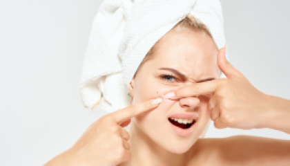 Acne_304x150_icon