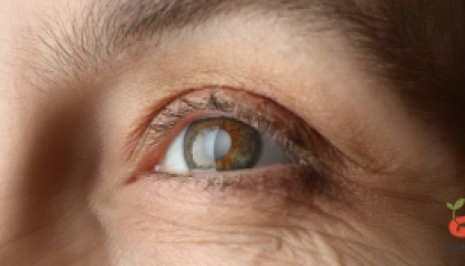 cataract_cover