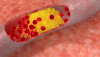 cholesterol_cover